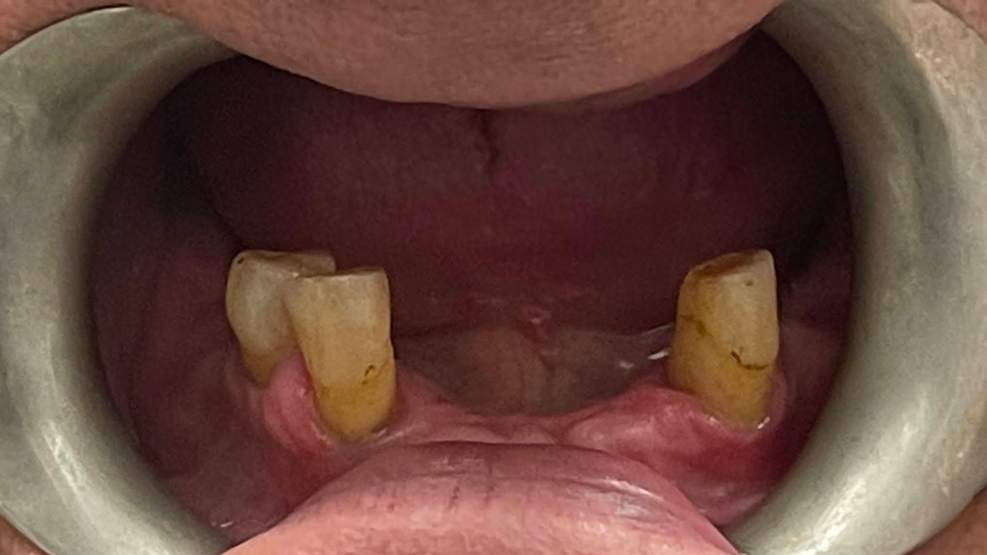 Patient before dental transformation