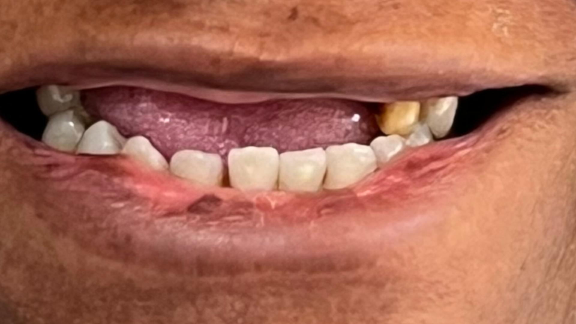 Patient before dental transformation